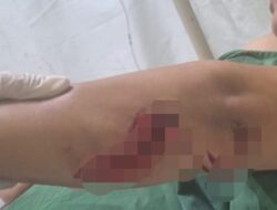 Oyong Hantamkan Pecahan Botol ke Tubuh Seorang IRT
